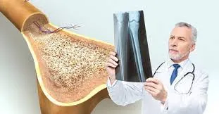 ясны сийрэгжилт