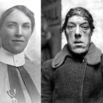 Үзэсгэлэнт бүсгүйгээс үзэшгүй төрхтэй болсон Мэри Эннийн түүх